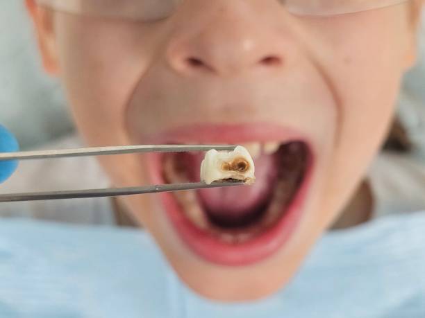 Best Emergency Denture Repair in Fairmont, WV